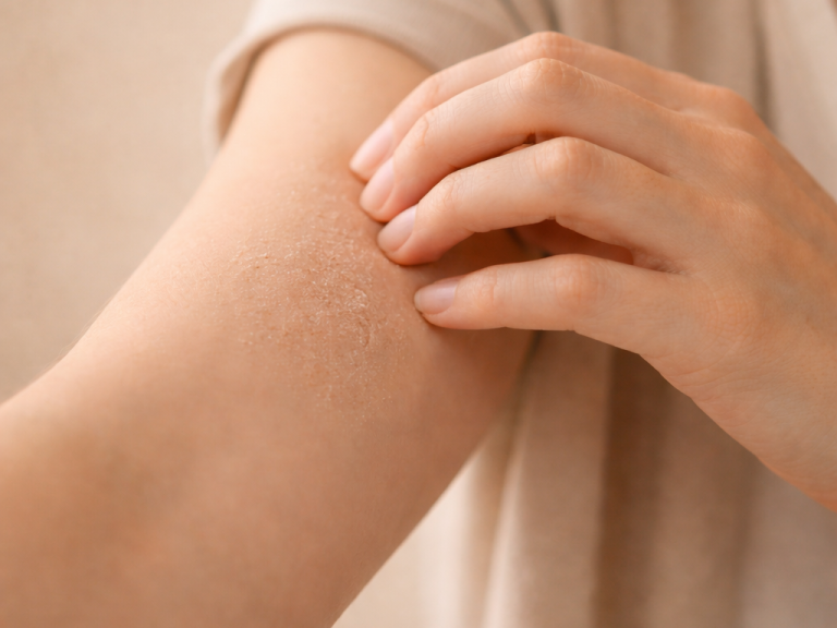 Eine Hand kratzt über trockene, schuppige Haut an einem Unterarm.